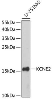 Western Blot: MiRP1 Antibody [NBP3-02949] - Western blot analysis of extracts of U-251MG cells, using MiRP1 antibody (NBP3-02949) at 1:1000 dilution. Secondary antibody: HRP Goat Anti-Rabbit IgG (H+L) at 1:10000 dilution. Lysates/proteins: 25ug per lane. Blocking buffer: 3% nonfat dry milk in TBST. Detection: ECL Basic Kit. Exposure time: 90s.